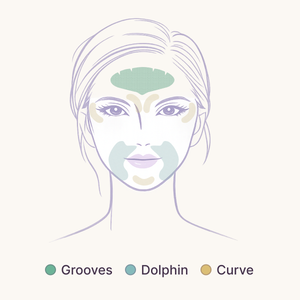 G14 Grooves, Dolphin and Curve placement