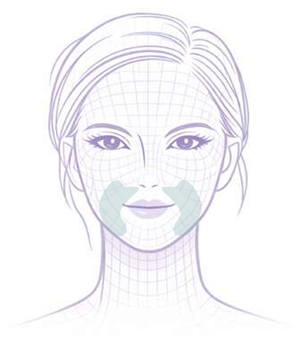 Dolphin placement on the face