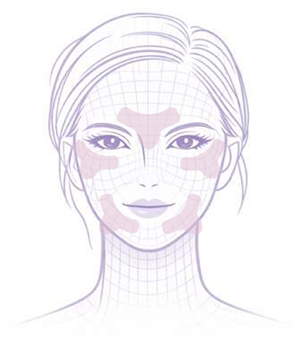 Y-Shape placement on the face